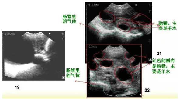 母豬懷孕妊娠25天前B超圖像
