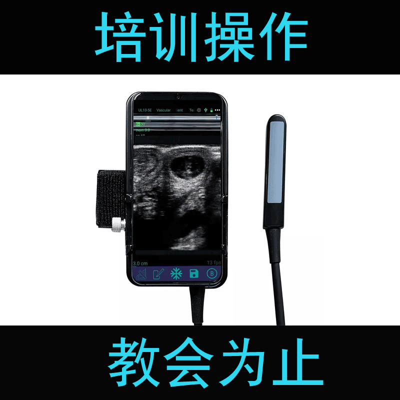 獸用b超牌子