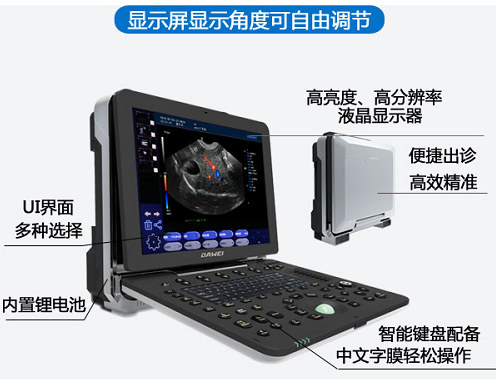 便攜式獸用b超機組成
